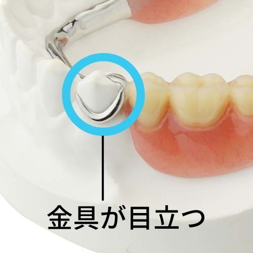 目立たない入れ歯